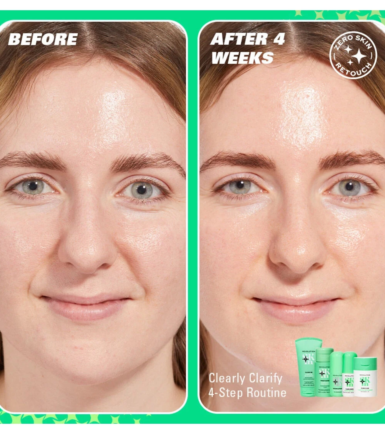 Revolution Skin - *Clearly Clarify* - Sérum facial clarificante Clear Canvas