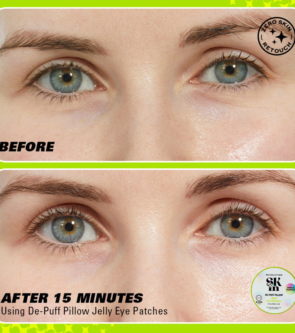 Revolution Skin - Parches hidrogel para ojos Jelly De-Puff Pillow